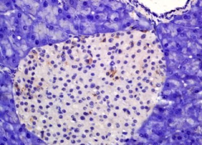 Phospho-HSL (Ser959 + Ser960) Rabbit Polyclonal Antibody
